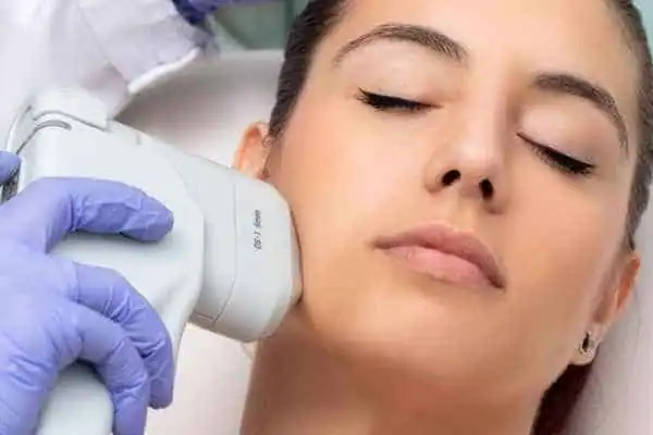 Image of woman having HIFU Loughborough treatment