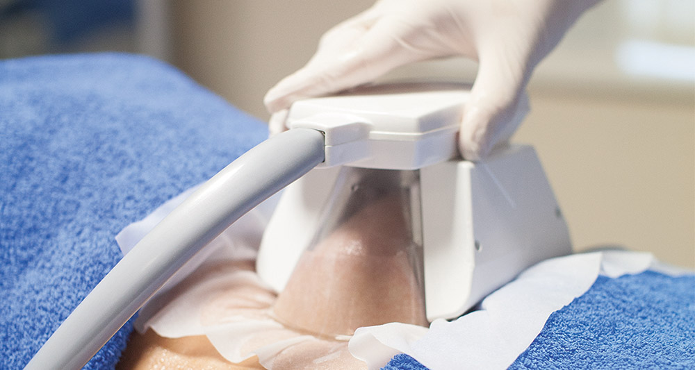 How Fat Freezing and HIFU Work Together? 2 Multiple Areas in One Session HIFU and Fat Freezing Loughborough