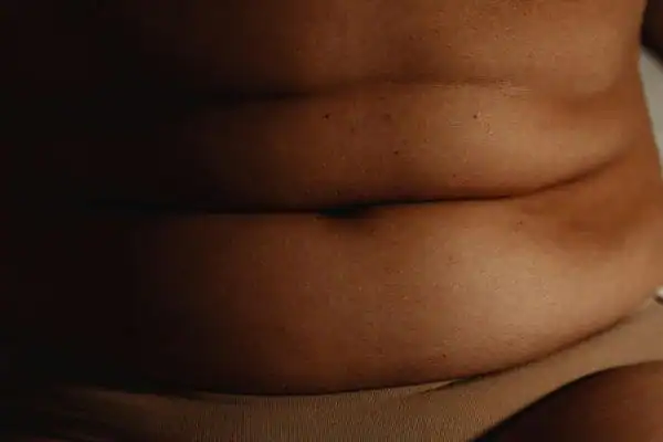 The Hidden Connection: How Stress Shapes Your Fitness and Body Composition 3 image of what stress can do on the stomach area and how Lipo 360 Loughborough can help to change your body shape.