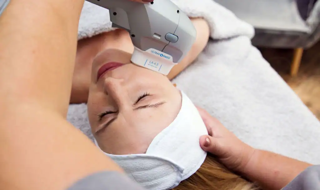 Discover the Perfect Duo: RF Microneedling and HIFU 1 Image of Morpheus8 And HIFU Loughborough combined treatment